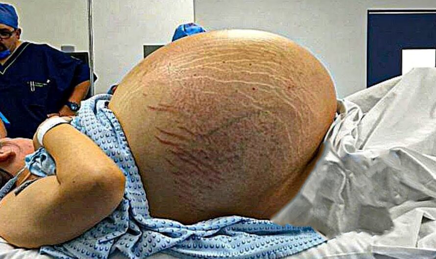 📢NOTICIA DE ÚLTIMA HORA 📢dijeron que estaba embarazada de gemelos. PERO!! No Creeras LO QUE LOS MÉDICOS VIERON CUANDO DIÓ A LUZ😱